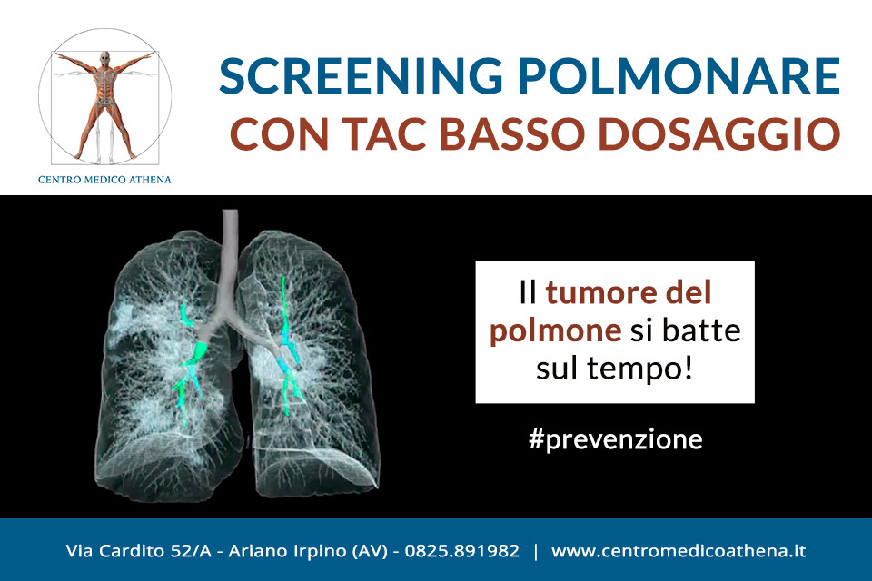 Screening polmonare con tac a basso dosaggio. ad Ariano Irpino, Avellino